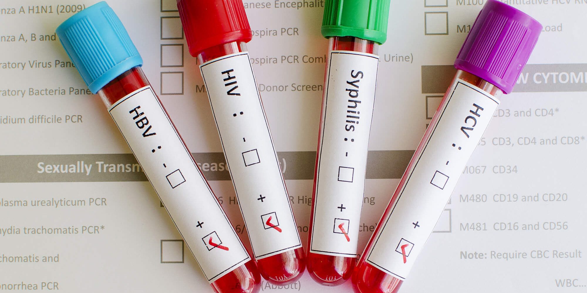 sexualne-prenosne-choroby