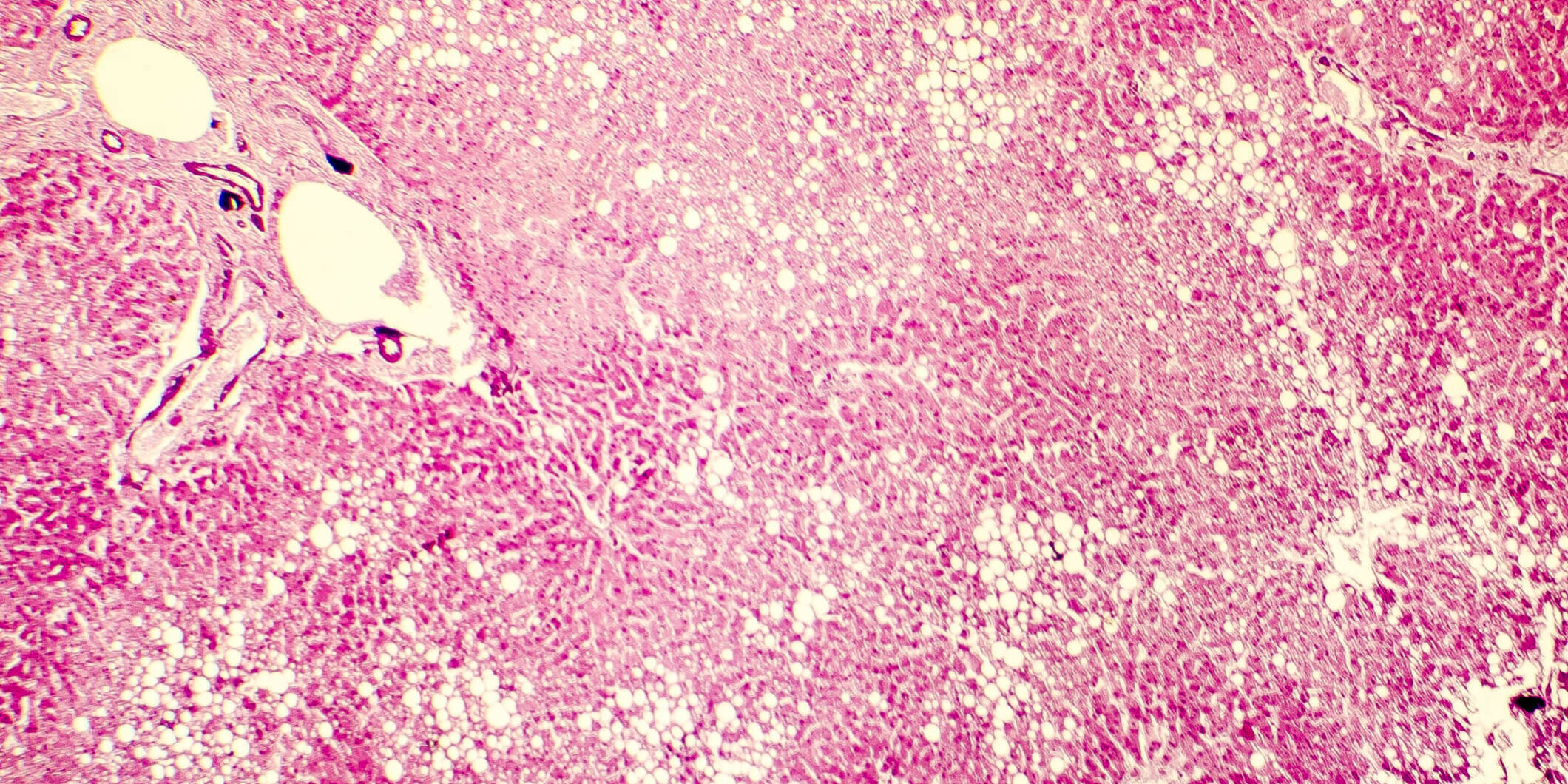 stukovatena-pecen stukovatena pecen